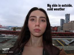 What Moisturizers Are Best for Sensitive Skin?