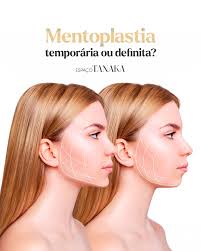 Jean Tanaka-Cirurgião Plástico (@drtanakaplastica) • Instagram photos and  videos