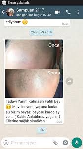 Sac Cikaran Losyon Sampuan Ve Tarak Binox Sac Cikaran Mavi Su Serum Ve Sampuan Losyon Ilac Facebook