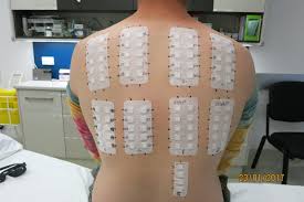 Image result for Patch Testing