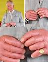 Fingers of Charles III, King of England. : r/TerrifyingAsFuck