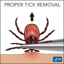 Image result for Tick Removal