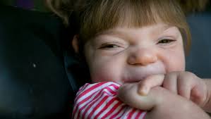 Community helps child with rare condition