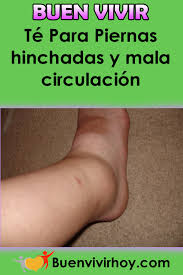 Te Para Piernas Hinchadas Y Mala Circulacion Te Piernas Hinchadas Circulacion Reme Remedios Para La Circulacion Remedios Para La Artritis Mala Circulacion