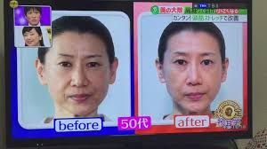肩こりで目が小さくなるし老け顔になるし大変だなって思ったら 頭筋ストレッチ 老け顔 肩こり 頭 小さく