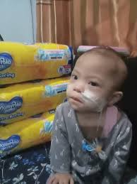 Dana Digunakan Untuk Membantu Shanum Penderita Jantung Bocor, Pneumonia Dan  Down Syndrome