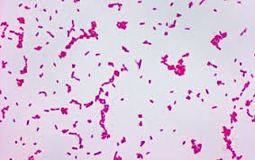 Image result for Shigella