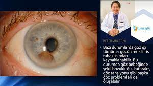 Murat Tunc Goz Goz Tumoru Belirtileri Nelerdir Facebook