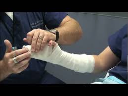 Image result for Ulnar Gutter Splint
