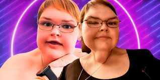 1000-Lb Sisters: I'm Sure Tammy's Living Situation & Skin Removal Plans Can  Change Her Life Forever (She's So Close To Making Her Dreams Come True)