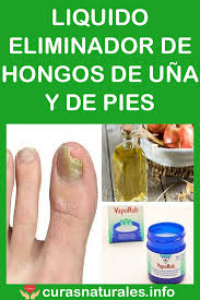 Hongos En Las Uñas De Las Manos Como Eliminarlos Liquido Eliminador De Hongos De Una Y De Pies Remedio Para Hongos Hongos En Las Unas Hongos Unas Pies