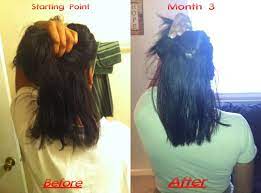 'hair growth' is a complex concept which embraces many dimensions: Pin On Hair Style
