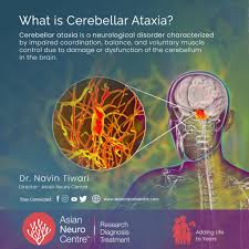 Image result for Ataxia