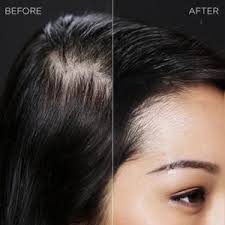 Toppik causing hair loss ?? Toppik Hair Building Fibers Cvs Pharmacy