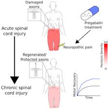 early administration of gabapentinoids improves motor