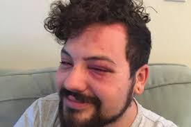 Fundraiser for Devin Rodriguez by Ben Schlesinger : Help Devin Rodriguez