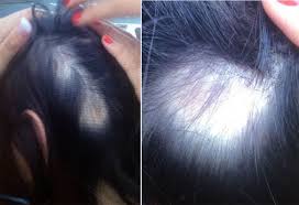 Customer service contact information for wen hair care. Wen Hair Care Lawsuit See Photos Of Hair Loss People Com