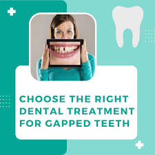 Choose The Right Dental Treatment For Gapped Teeth - Cumbria Smiles