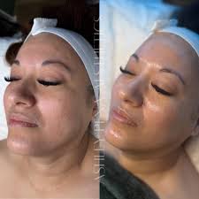 Wait. I know Belle is medium but THIS does not look medium at all. Can we  get this skin instead of the one they gave out instead? Pretty please?  Hoyo?