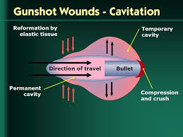 How long will it take it to reach its highest point and how high will that be? Do You Need To Remove A Bullet Carenade The Home Care Agency Center