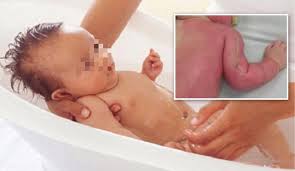 Check spelling or type a new query. Salerno Fanno Bagnetto Al Bimbo Con Acqua Bollente E Ricoverato Al Cardarelli