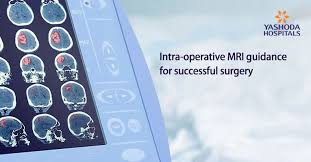 Intraoperative Mri Imri For Brain Surgery In India