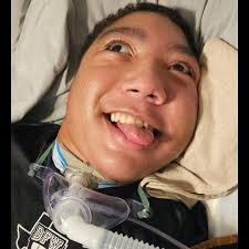 Meet Dr. PVLN Murthy, a distinguished ENT surgeon with over 12 years of  experience. Specialising in minimally invasive ear surgeries,  plasma/coblation technology for tonsil and adenoid procedures, and balloon  sinuplasty for sinus