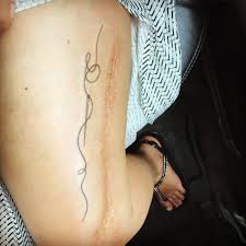 Needle And Thread Tattoo Near Scar Finally Got It Done Tattoos Cool Tattoos Hair Skin Nails