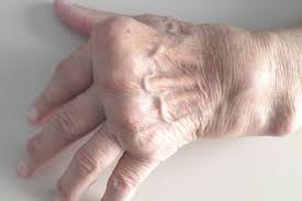 See more of maladie de kawasaki on facebook. Infos Patients Medecine Interne Imm Institut Mutualiste Montsouris