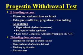 Image result for Progesterone Challenge Test