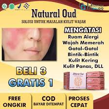Kamu bisa mencari masker wajah, seperti sheet mask. Obat Ruam Wajah Alami Sabun Atasi Ruam Alergi Wajah Memerah Perih Dan Gatal Bintik Bintik Merah Kulit Kering Bentol Bentol Gatal Bila Berkeringat Kulit Terasa Panas Terbakar Dermatitis Natural Oud Sabun Wajah
