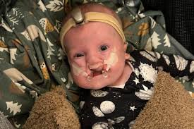 Fundraiser for Steven Strauss by Brian Strauss : Support Baby Henry's  Medical Journey