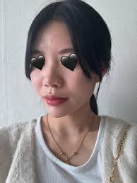 For those who are considering rib cartilage rhinoplasty :  r/SeoulPlasticSurgery