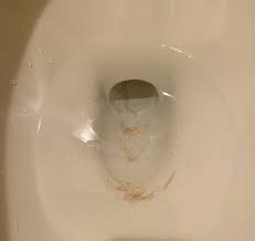 We did not find results for: How Do I Remove This In My Toilet Hometalk