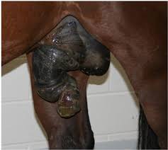 Image result for paraphimosis