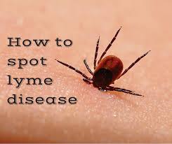 Image result for infected tick bite