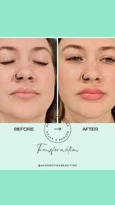 Alex Hackett, MSN, RN (@agedefyingbeautyaz) • Instagram photos and videos