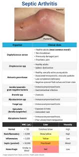 Image result for Septic Joint