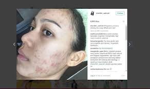 Hari ini saya pakai lipstik merah, spender Sharifah Sakinah Masih Ingin Berlakon