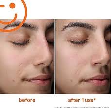 Amazon.com: Kate Somerville ExfoliKate Cleanser