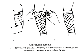 Maybe you would like to learn more about one of these? Kolosovidnaya Povyazka Vidy I Tehnika Nalozheniya