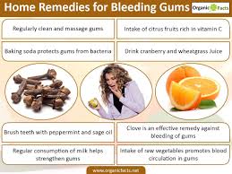 Let's be honest, we all want gorgeous, straight teeth. How To Stop Tooth Bleeding At Home Arxiusarquitectura