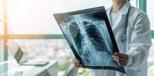 Image result for XRay Interpretation