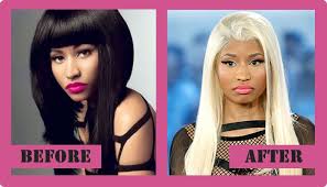 Pin On Plastic Surgery