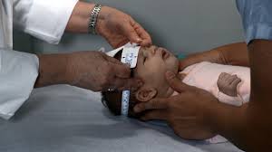 measuring infant head circumference an instructional video for healthcare providers