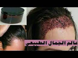 سبحان الله مكون واحد فقط لانبات الشعر وتكثيفة وعلاج الصلع والشيب لن تصدق من أول استعمال مع ضحى y hair care recipes beauty skin care routine beauty skin