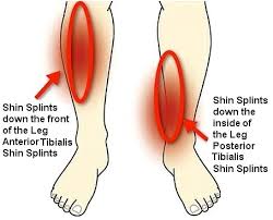 Stretches For Shin Splints And How To Prevent Shinsplints Shin Splints Stretches Shin Splint Exercises Shin Splints