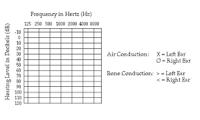 Blank Audiogram Template Audiograms Aussie Deaf Kids