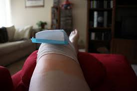 Most Patients Undergoing Total Knee Replacement Surgery Want To Know When They Ll B Knee Replacement Exercises Total Knee Replacement Knee Replacement Recovery