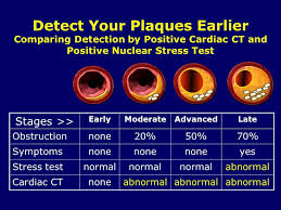 Coronary Calcium Scan Degomamd Clinic More Science